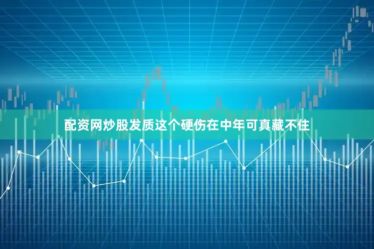 配资网炒股发质这个硬伤在中年可真藏不住